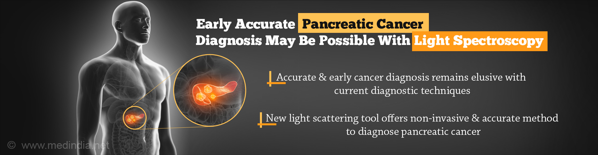 Early accurate pancreatic cancer diagnosis maybe possible with light spectroscopy
- Accurate & early cancer diagnosis remains elusive with current diagnostic techniques
- New light scattering tool offers non-invasive & accurate method to diagnose pancreatic cancer