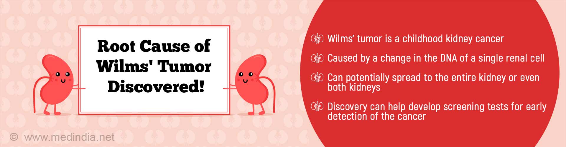 Root cause of Wilms' tumor discovered! Wilms' tumor is a childhood kidney cancer. Caused by a change in the DNA of a single renal cell. Can potentially spread to the entire kidney or even both kidneys. Discovery can help develop screening tests for early detection of the cancer.