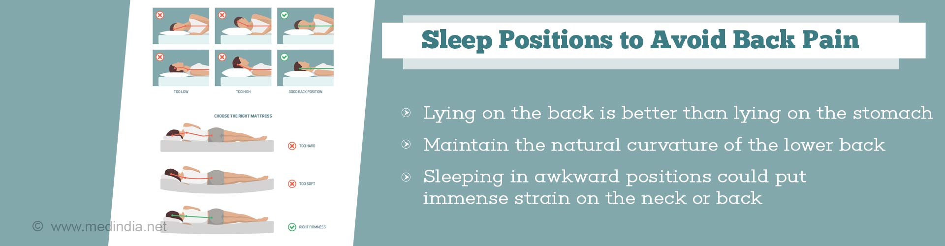 Sleep positions to avoid back pain
- lying on the back is better than lying on the stomach
- maintain the natural curvature of he lower back
- sleeping in awkward positions could put immense strain on the neck or back