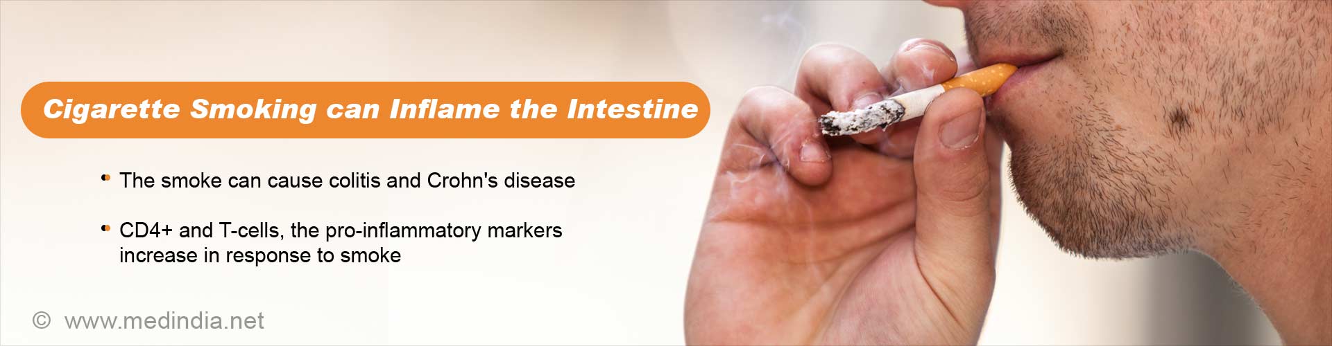 cigarette smoking can inflame the intestine
- the smoke can cause colitis and Crohn's disease
- CD4+ and T-cells, the pro-inflammatory markers increase in response to smoke