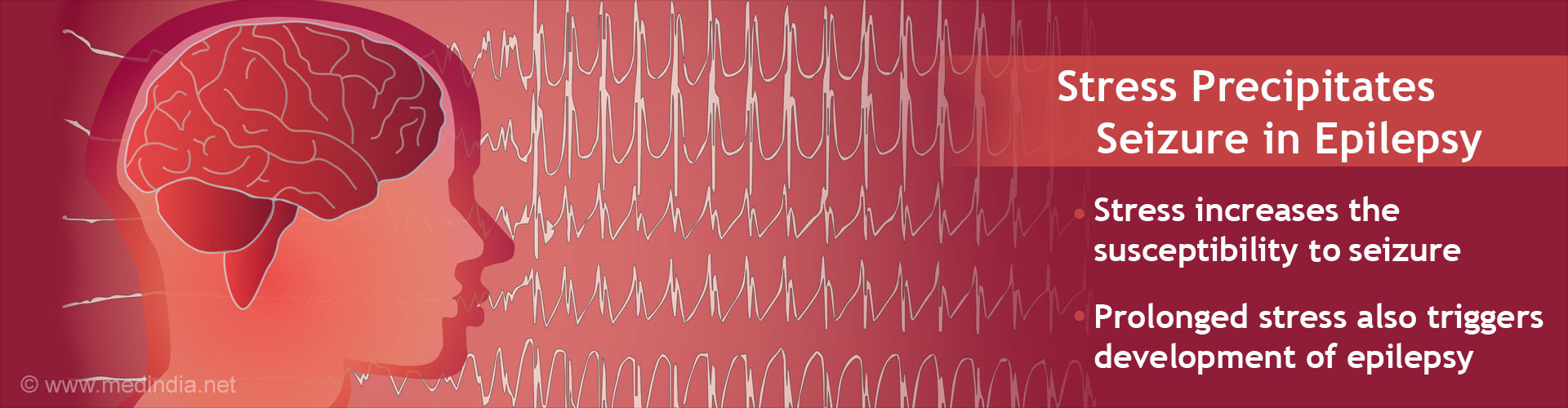 Stress Triggers Seizure in Epilepsy Patients