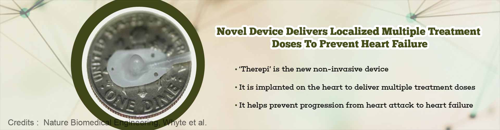 Novel device delivers localized multiple treatment doses to prevent cardiac failure. 'Therepi' is the new non-invasive device. It is implanted on the heart to deliver multiple treatment doses. It helps prevent progression from heart attack to heart failure.