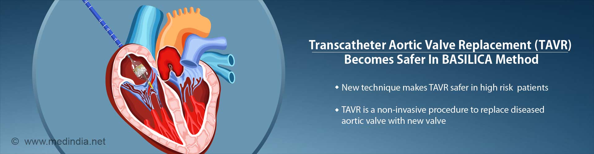 Health Tip on New Technique Reduces Risk of Coronary Obstruction During