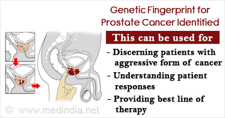 aggressive prostate cancer prognosis)