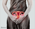 Adenomyosis | Bulky Uterus
