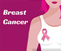 Simple Ways to Prevent Breast Cancer