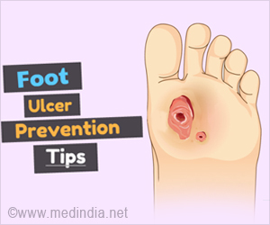 Foot Ulcer Prevention Tips