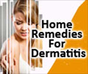 Home Remedies for Dermatitis