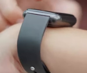 Smartwatches: A Game-Changer for Psychiatry