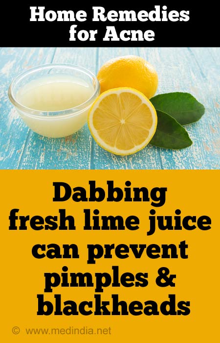 Natural methods to remove pimples