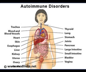 Autoimmune Disorders
