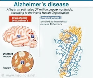 Alzheimer's disease - Gene Boosts Memory