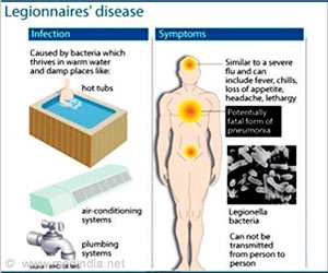 Legionnaires' disease