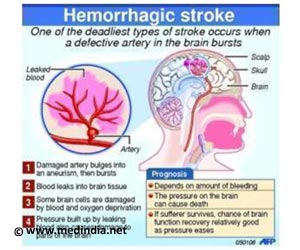 Stroke - Mortality Rate