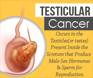 Testicular Cancer