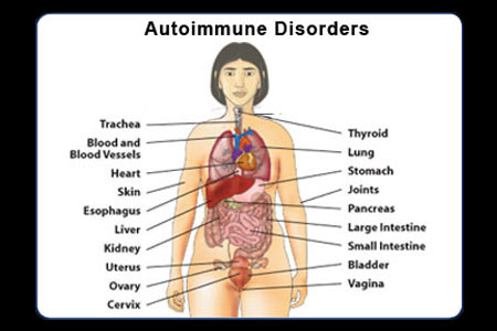 Autoimmune Disorders - Infographic