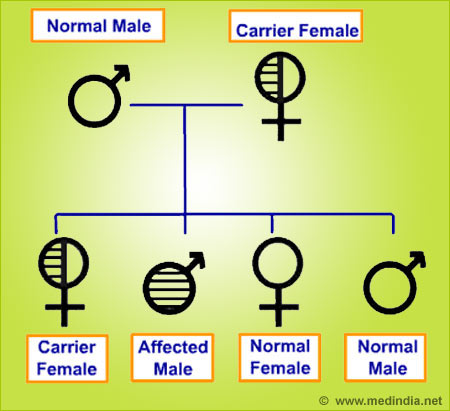 Hemophilia - Infographic