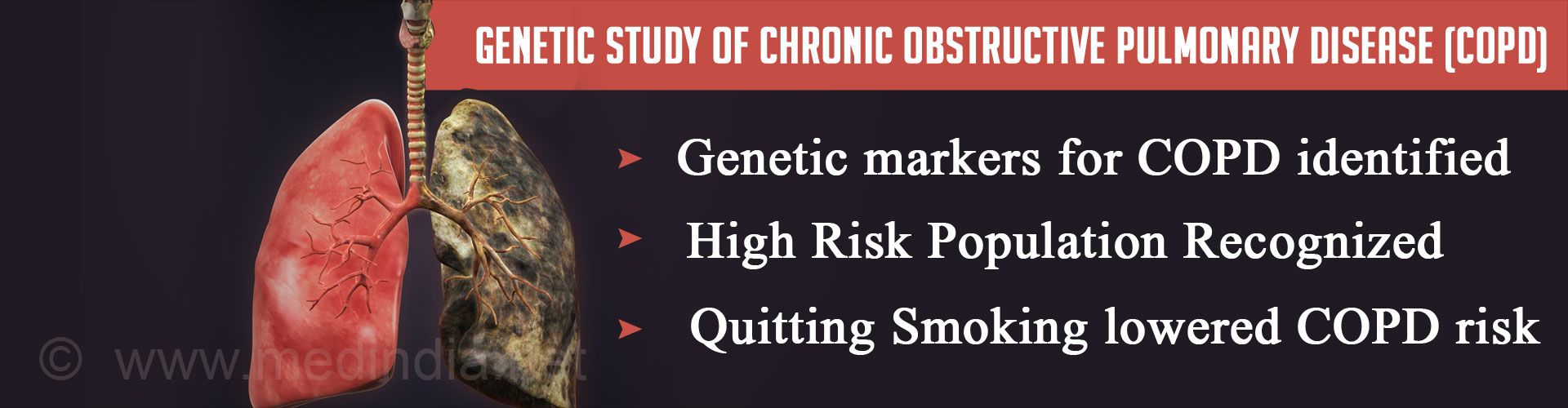 Predicting Risk for Chronic Obstructive Pulmonary Disease