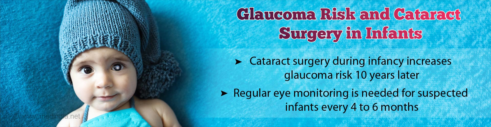 Cataract Surgery in Infants Might Increase Risk of Glaucoma