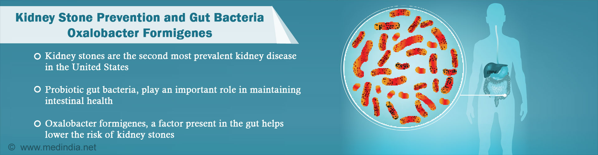 kidney-stone-prevention-and-gut-bacteria-oxalobacter-formigenes.jpg