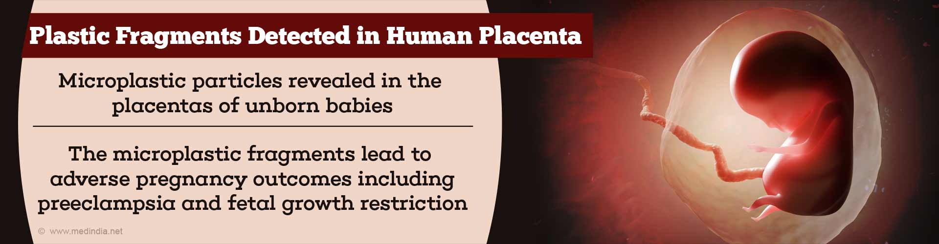 Plastic Pollution Enters Human Placenta