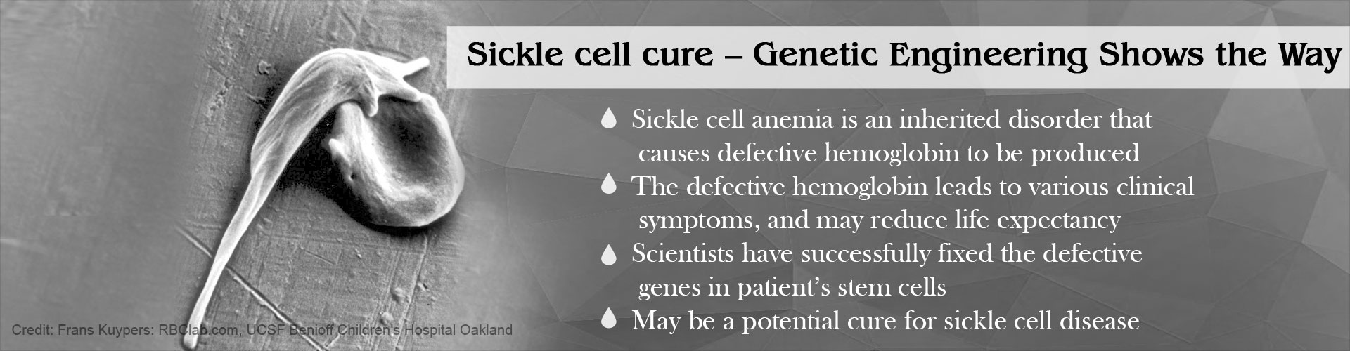 Sickle Cell Cure – Genetic Engineering Shows The Way