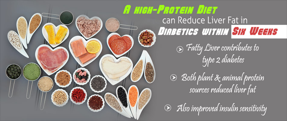 Protein-Rich Diet can Reduce Fatty Liver Disease