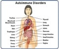 Autoimmune Disorders                                                                                                                                                                                    