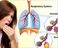 Hemoptysis Symptom Evaluation                                                                                                                                                                           