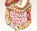 Stomach / Intestinal / Abdominal Tuberculosis - Causes, Symptoms, Diagnosis, Treatment