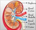 Acute Renal Failure                                                                                                                                                                                     