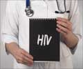 AIDS/HIV- Clinical Features