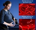 Anemia in Pregnancy