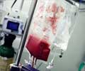 Blood Transfusion                                                                                                                                                                                       