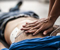 Cardiac Arrest - Causes, Symptoms, Risk factors, Complications, Diagnosis, Treatment, Prevention