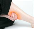 Claudication - Causes Symptoms Diagnosis Treatment Prevention