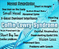 Coffin-Lowry Syndrome - Causes, Symptoms, Diagnosis, Treatment, Health Tips