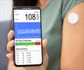 Continuous Glucose Monitoring (CGM)