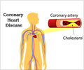 Coronary Heart Disease - Causes, Symptoms, Risk Factors, Diagnosis, Tretment