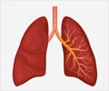 Cystic Fibrosis - Symptoms, Causes, Diagnosis, Treatment, Support Groups Cystic Fibrosis - Symptoms, Causes, Diagnosis, Treatment, Support Groups