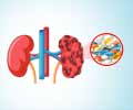 Drug-Induced Kidney Disease