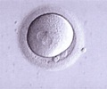 Egg Donation                                                                                                                                                                                            
