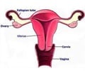 Endometrial Cancer