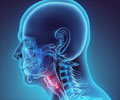 Epiglottitis - Causes, Signs and Symptoms, Diagnosis, Treatment & Prevention