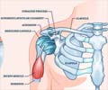 Frozen Shoulder | Adhesive Capsulitis - Causes, Symptoms, Diagnosis, Treatment & Prevention