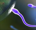 Genetics of Male Infertility                                                                                                                                                                            