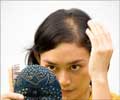 Hair Loss | Alopecia in Women