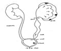Hydronephrosis / Antenatal Counseling                                                                                                                                                                   