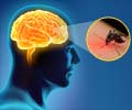 What You Should Know about Japanese Encephalitis - Types, Causes, Symptoms, Diagnosis & Treatment
