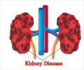 Prevention of Kidney Disease